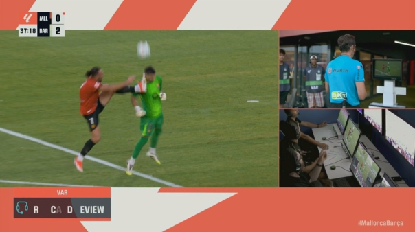 开云-爱游戏-遭鞋钉踹脸😣巴萨门将加西亚右脸肿了个大包，赛后清晰可见